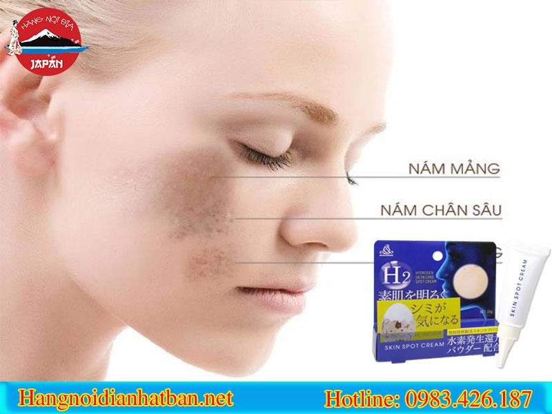 H2 Skin Spot Cream ứng dụng công nghệ trị nám mới nhất H2 Skin Spot Cream ứng dụng công nghệ trị nám mới nhất