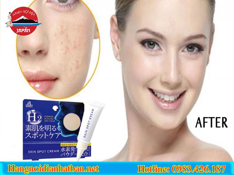 Kem Trị Nám H2 Hydrogen Skin Spot Cream 10g "Bí